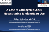 A Case of Cardiogenic Shock Necessitating TandemHeart Use