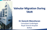 Valvular Migration During TAVR