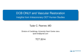 DCB ONLY and Vascular Restoration: Insights from Intracoronary OCT Human Studies
