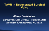 TAVR Implantation in Degenerated Surgical Valves
