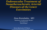Endovascular Treatment of Nonatherosclerotic Arterial Diseases of the Lower Extremities