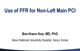 Use of FFR for NonLeft Main Bifurcation PCI