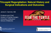 Tricuspid Regurgitation: Natural History and Surgical Indications and Outcomes