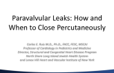 Paravalvular Leaks: How and When to Fix Them Percutaneously