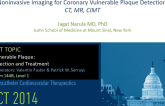 Noninvasive Imaging Modalities for Coronary VP Detection: CT, MR, and CIMT