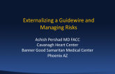 Externalizing the Guidewire and Managing the Risks