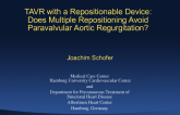Case #1: TAVR with a Repositionable Device: Does Multiple Repositioning Avoid Paravalvular Aortic Regurgitation?