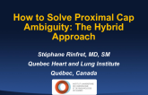 How to Solve Proximal Cap Ambiguity: The Hybrid Approach