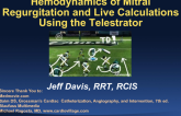 Hemodynamics of Mitral Regurgitation and Live Calculations Using the Telestrator