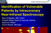 TCT 398: Identification of Vulnerable Patients by Intracoronary Near-Infrared Spectroscopy