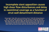 TCT 365: Incomplete Stent Apposition Causes High Shear Flow Disturbances and Delay in Neointimal Coverage as a Function of Strut-to-Wall Detachment Distance