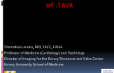 Evolution of Echo Assessment of TAVR