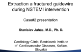 Case #2: Extraction of a Fractured Guidewire During NSTEMI Intervention