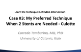 Case #3: My Preferred Technique When 2 Stents are Needed - Culotte