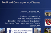 Coronary Artery Disease and TAVR: Who, When, and How to Revascularize?