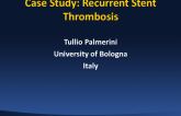 Case Study: Recurrent Stent Thrombosis