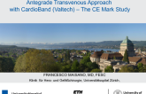 Antegrade Transvenous Approach with Atrial Banding (Valtech)  The CE Mark Study