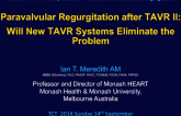 Paravalvular Regurgitation After TAVR II: Will New TAVR Systems Eliminate the Problem?