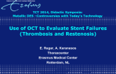 Use of OCT to Evaluate Stent Failures (Thrombosis and Restenosis)
