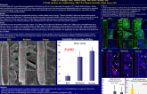 Comparison of endothelialization and inflammation between thin- and thick-strut contemporary bioerodable polymer drug-eluting stents and thick-strut fully resorbable scaffolds i___