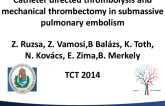 Catheter directed thrombolysis and mechanical thrombectomy pulmonary embolism