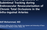 Predictors and Implications of Subintimal Tracking During Endovascular Revascularization of Chronic Total Occlusions in the Infrainguinal Arteries