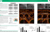 Comparison of sirolimus-eluting stents with biodegradable polymer versus zotarolimus-eluting stents with durable polymer assessed by optical coherence tomography: The ALSTER-OCT___
