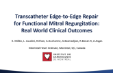 Transcatheter Edge-to-edge Repair for Functional Mitral Regurgitation: Real-World Clinical Outcomes
