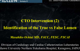 Case #5: CTO Intervention II  Identification of the True vs False Distal Lumen