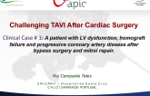 Case #1: A Patient with LV Dysfunction, Homograft Failure, and Progressive Coronary Artery Disease After Bypass Surgery and Mitral Repair