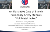 An Illustrative Case of Branch Pulmonary Artery Stenosis