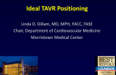 Ideal Transcatheter Valve Positioning (for Self-Expanding and Balloon-Expandable Valves)