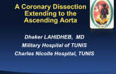 Case #2: A Coronary Dissection Extending to the Ascending Aorta