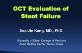 Case #3: OCT Evaluation of Stent Failure