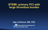 Case #1: STEMI: Primary PCI with Large Thrombus Burden