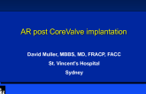 Case #2: Management of TAVI Complications