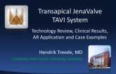 JenaValve - Technology Review, Clinical Results (JUPITER), AR Applications, and Case Examples