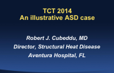 An Illustrative ASD Case