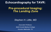 Preprocedural Imaging: The Landing Zone (Including the Annulus)