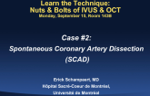 Case #2: Spontaneous Coronary Dissection