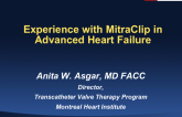 Experience with MitraClip in Advanced Heart Failure
