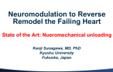 Neuromodualtion to Reverse Remodel the Failing Heart: Start of the Art