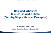 How and When to: Minicrush and Culotte (Step-by-Step with Case Examples)