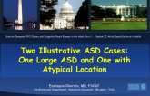 Two Illustrative ASD Cases: One Large ASD and One with Atypical Location