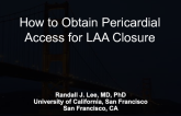 How to Obtain Pericardial Access for LAA Closure