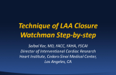 Watchman Step-by-Step