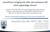 TCT 174: Cardiac CT Angiography Is a Useful Noninvasive Surveillance Imaging Test After Percutaneous Left Atrial Appendage Closure