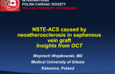 Case #1: NSTE-ACS Caused by Neoatherosclerosis in Saphenous Bypass Grafts: Insights from OCT