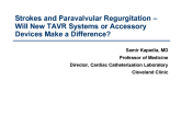 TAVR Controversies: Strokes and Paravalvular Regurgitation  Will New TAVR Systems or Accessory Devices Make a Difference?
