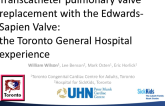 Transcatheter pulmonary valve replacement with the Edwards-Sapien Valve: The Toronto Congenital Cardiac Centre for Adults Experience